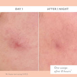S.O.S Totally Invisible Clarifying Liquid Patch