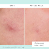 S.O.S Totally Invisible Clarifying Liquid Patch