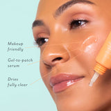 S.O.S Totally Invisible Clarifying Liquid Patch