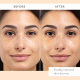 Skin Remedy Barrier-Boosting Sheet Mask - Single