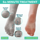 PoshPeel Pedi Cure